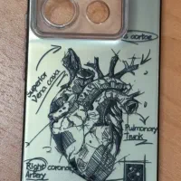 قاب نوت ۱۳ پرو۵جی