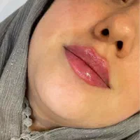 بوتاکس و شیدینگ و میکروپیگمنتیشن تخفیف ویژه|خدمات آرایشگری و زیبایی|بیرجند, |دیوار