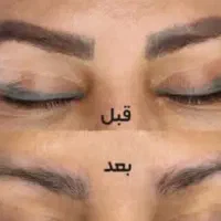 ریموو (پاک کردن وحذف)تتو ابرو