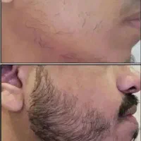 باپکیج رویش ریش وسیبیلت رو بساز