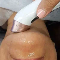 فیشیال تخصصی  ویژه آقایون و خانم ها