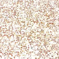 کف سابی و موزاییک سازی