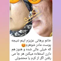 لاغری، کیست و تنبلی تخمدان، کبدچرب، پوست ومو|آرایشی، بهداشتی، درمانی|مشهد, خواجه ربیع|دیوار