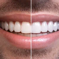 خدمات ویژه دندانپزشکی اقساطی،ایمپلنت،ارتودنسی،