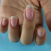 مدل + مشتری ناخن حرفه‌ای بندرعباس (فقط هزینه مواد)|خدمات آرایشگری و زیبایی|بندرعباس, |دیوار