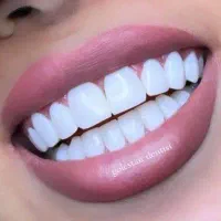 خدمات کامپوزیت،روکش،دندان مصنوعی|خدمات آرایشگری و زیبایی|چهاردانگه (تهران), |دیوار