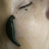 حجامت و زالو درمانی و بادکش ب صورت تخصصی|خدمات آرایشگری و زیبایی|شیراز, شهرک ولیعصر|دیوار