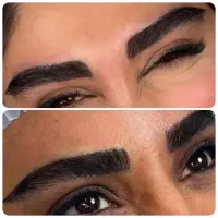 کیفیت کاشت ابروتخصصی وکاشت مو با تراکم بالا