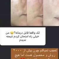پک صورت گیاهی ضدلک و کک مک|آرایشی، بهداشتی، درمانی|آباده, |دیوار