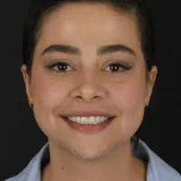 ایمپلنت اقساط بدون سود/جشنواره پاییزی به مدت محدود|خدمات آرایشگری و زیبایی|تهران, مجیدیه|دیوار