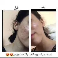 محصولات مراقبتی پوست و مو و سلامت بدن|آرایشی، بهداشتی، درمانی|خوی, |دیوار