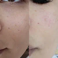 فیشال و پاکسازی پوست ،پدیکور|خدمات آرایشگری و زیبایی|اهواز, فولادشهر|دیوار
