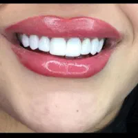 تخفیف یلدایی