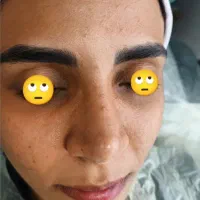 انجام خدمات فوق تخصصی پوست ویژه بانوان
