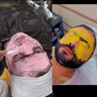 پاکسازی جوان سازی پوست 10سال سابقه مدرک ترکیه