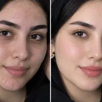 ادیت حرفه ای عکس