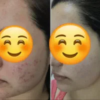 کرم سفیده کننده صددرصد تضمینی|آرایشی، بهداشتی، درمانی|رفسنجان, |دیوار