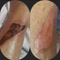 خدمات پرستاری.پانسمان.تزریقات وسرم.کمترین قیمت|خدمات آرایشگری و زیبایی|اهواز, ۳۰ متری|دیوار