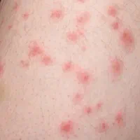 خدمات تخصصی و%100 تضمینی سمپاشی