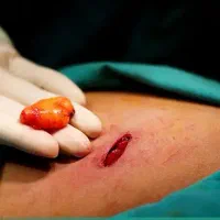 انجام جراحی های سر پایی