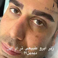 جشنواره کاشت ابرو سبک تهرانی و کاشت مو|خدمات آرایشگری و زیبایی|مشهد, وکیل‌آباد|دیوار