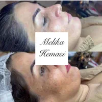 فیشیال و جوانسازی و پاکسازی صورت|خدمات آرایشگری و زیبایی|اصفهان, خلجا|دیوار