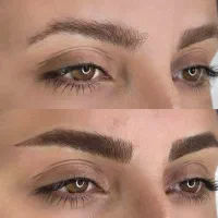 میکروبلیدینگ و فیبروز ابرو