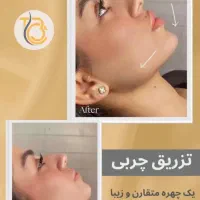 کاشت مو و ابرو / بوتاکس / چربی ژل /کلینیک /زیبایی|خدمات آرایشگری و زیبایی|بوکان, |دیوار