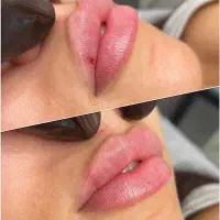 پوست صاف|خدمات آرایشگری و زیبایی|تهران, قبا|دیوار