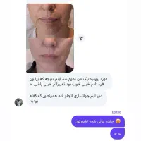 جوانساز جهانی بیوممتیک|آرایشی، بهداشتی، درمانی|ساری, |دیوار