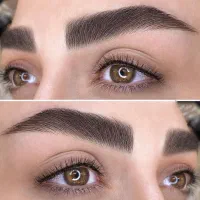 فیبروز و میکرو تخصصی(نوبهار)