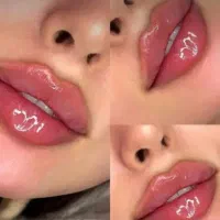 فول فیس،زاویه آقایان،ژل،بوتاکس زیربغل،فیلربادیprp|خدمات زیبایی و سلامت|تبریز, |دیوار