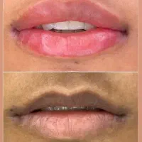 خداحافظی با تیرگی لب