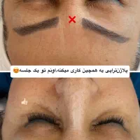 پاکسازی+ درما رایگان (۱۷۵ تومان )در کلینیک پزشک|خدمات آرایشگری و زیبایی|بیرجند, |دیوار