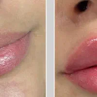 تخفیف ویژه ژل لب، فول فیس اموزش و تمام خدمات|خدمات آرایشگری و زیبایی|صدرا-فارس, فاز ۱|دیوار