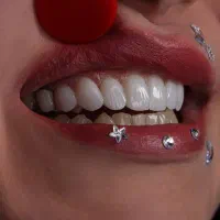 ایمپلنت اقساط بدون سود/شروع با ۱۴٪