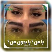 کاشت مو،ابرو،ریش و بلفاروپلاستی