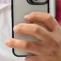 ایفون ۱۳ نرمال