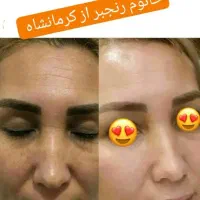 صابون لایه بردار گیاهی روشن کننده صورت وبدن|آرایشی، بهداشتی، درمانی|اهواز, آریاشهر|دیوار