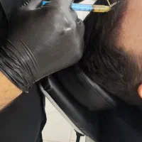 معجزه جوانسازی صورت و کمک به رویش مجدد مو با PRP