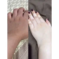 کرم تضمینی جواب نگرفتی پولتوپس بگیر