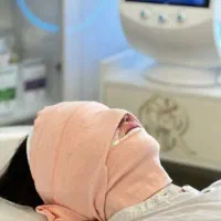 کربوکسی تراپی صورت و بدن