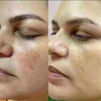 کرم بیوممتیک معجزه قرن اصلی