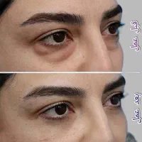 جراحی و زیبایی صورت و بدن، مزو، بوتاکس، چربی، فیلر|خدمات آرایشگری و زیبایی|کرمانشاه, |دیوار