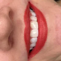 خدمات دندان پزشکی با تخفیف ویژه پاییز ( 50٪ )سنندج|خدمات آرایشگری و زیبایی|مریوان, |دیوار