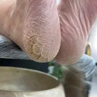 پدیکور،کفسابی از ۲۸۰تا ۳۹۰