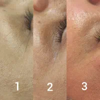 فیشال و پاکسازی پوست