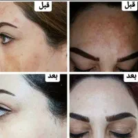 کرم اصل اماراتی وی آی پی|آرایشی، بهداشتی، درمانی|میناب, |دیوار