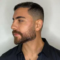 جشنواره تخفیف تزریق ژل و بوتاکس کانتورینگ فیشیال|خدمات آرایشگری و زیبایی|کرج, گلشهر|دیوار