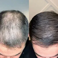اگر از کم‌پشتی مو خسته شدی، اینو ببین